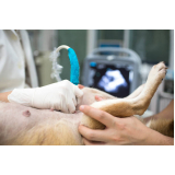exame de ultrassom abdominal para cachorro preço Vila Valparaíso